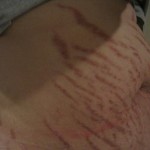 050611-anon-2