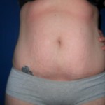 050611-anon2-1