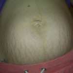070711-anon-1 070711-anon-1