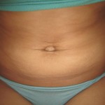 072711-anon-2