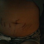 081211-anon-5
