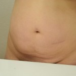 081811-anon-2 081811-anon-2