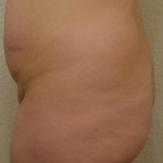081811-anon-3 081811-anon-3