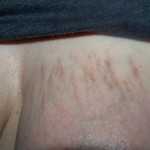 081911-anon-1