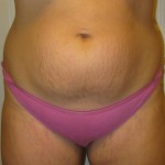 101411-anon-6 101411-anon-6
