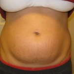 101411-anon-7 101411-anon-7