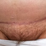 122011-anon-5 122011-anon-5