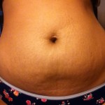 020812-anon-3 020812-anon-3
