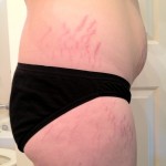 051612-anon2-4