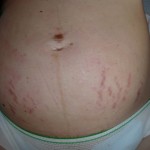 060112-anon-3 060112-anon-3