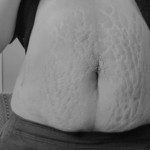 090312-anon-2