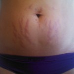 090612-anon-1