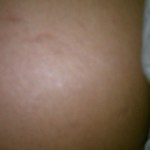 100312-anon-2 100312-anon-2