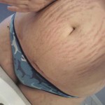 Nude Moms With Stretch Marks